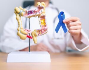 colon cancer screening