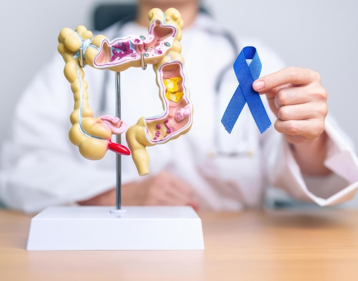 colon cancer screening