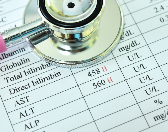 Cirrhosis symptoms